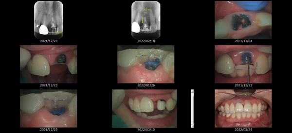MTMを使用した治療画像