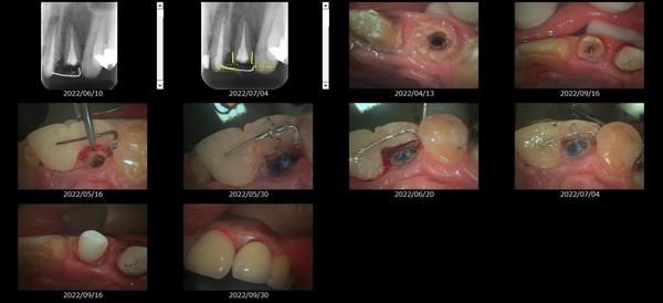 MTMを使用した治療画像