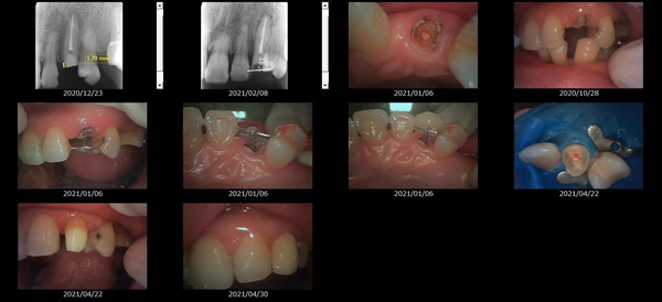 MTMを使用した治療画像