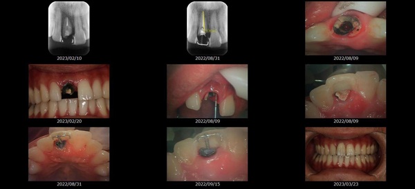MTMを使用した治療画像
