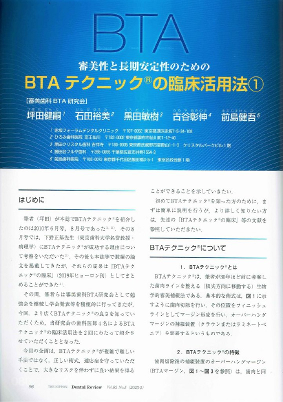 歯科の月間機関紙　歯科評論の特集で２巻にわたる 　【BTAテクニックR　の臨床応用活用法】（2023年5月, 号7月号）2