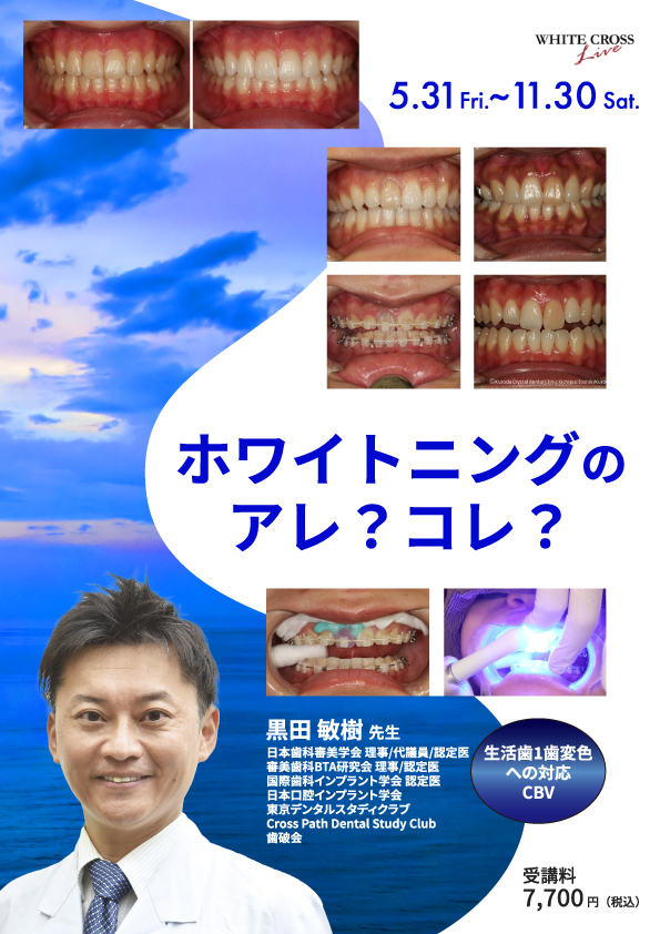 歯科医師、歯科衛生士向けの医療ホワイトニングについてのWEBセミナーにて講師を務めました