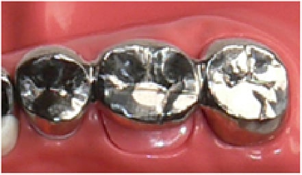 金銀パラジウム合金