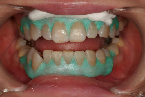 ティオンウィズ（約16.6％）